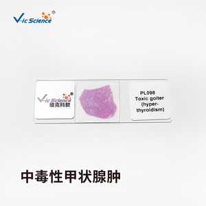 Lames de Pathologie Médicale Humaine 50 pièces, Lames de Pathologie Vétérinaire, <span class=keywords><strong>Papillome</strong></span> Cutané, Lames de Pathologie Médicale - Product Image 6