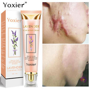 Creme Facial Yoxier Loção Reparadora de Cicatrizes de Acne Estrias Corretor de Pigmentação Antialérgico Calmante Clareador para Cuidados com a Pele - Product Image 4