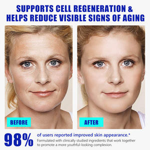 Vente en gros soins de la peau du visage de marque privée éclaircissant hydratation en profondeur anti-âge raffermissant pour la peau lisse les rides sérum à cellules souches - Product Image 4