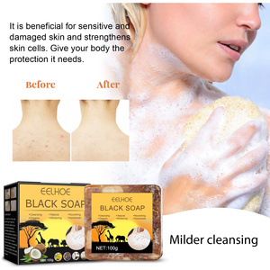 Deep Cleansing Moisturizing Black <b>Soap</b> Anti Acne Whitening <b>Soap</b> Organic Handmade Black <b>Soap</b> - Product Image 5