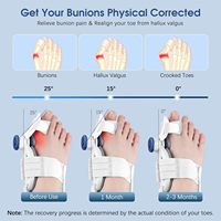 Correcteur d'Oignon Réglable pour Femmes et Hommes - Redresseur d'Orteil et Attelle Anti-Douleur, Correction d'Hallux Valgus (Blanc)