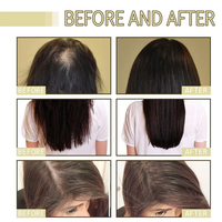 Serum Anti-Ketombe Saw Palmetto & Minyak Biji Labu, Perawatan Penumbuh & Penebal Rambut, Tidak Perlu Dikumprang