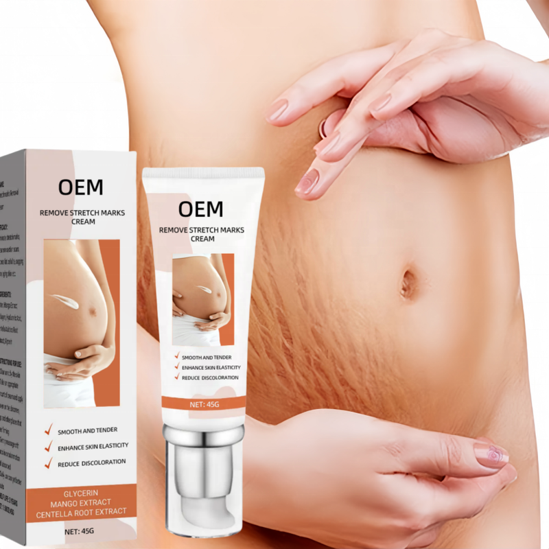 Best Natural Stretch Mark Cream Pregnancy