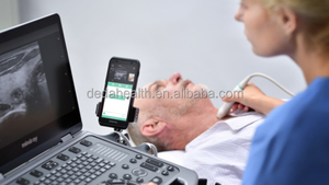 Échographe vétérinaire portable haut de gamme Mindray MX6, équipement médical à ultrasons Doppler couleur Mindray pour clinique vétérinaire - Product Image 6