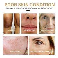 Sérum Éclaircissant Marque Blanche à l'Acide Kojique pour une Peau Éclatante à la Niacinamide et l'Élimination des Taches Brunes, Sérum Vitamine C