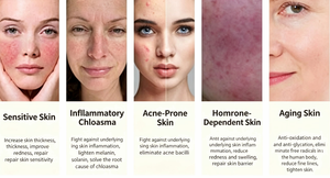 Suero Facial Personalizado con Proteína Adhesiva de Mucina de Mejillón Liofilizada, Repara la Piel Sensible con Acné, Marca Privada OEM - Product Image 5