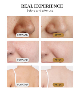 Appareil portable de nettoyage en profondeur du visage par dermabrasion à jet d'eau et d'oxygène pour le rajeunissement de la peau - Product Image 6