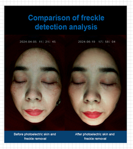 Offre Spéciale : Analyseur de Peau Numérique 3D, Miroir Magique, Scanner Facial avec Détection Intelligente par IA, Connectivité Wi-Fi pour Usage Commercial - Product Image 6