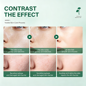Coffret soin visage ZLZR Centella Asiatica 6 pièces, Niacinamide, Acide Hyaluronique, hydratant, apaisant, réparateur, pour peaux sensibles - Product Image 2