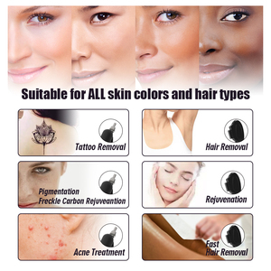 2023 công nghệ mới 3 trong 1 Máy tẩy lông <span class=keywords><strong>IPL</strong></span> OPT Elight Máy làm đẹp - Product Image 5