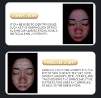 Detector de Piel Multiespectral S, Instrumento de Belleza para Análisis Integral de Colágeno, Sensibilidad, Pigmentación, Arrugas y Poros