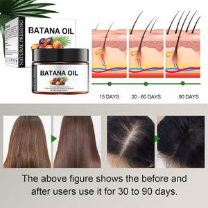 <span class=keywords><strong>Huile</strong></span> de batana pure, <span class=keywords><strong>huile</strong></span> de batana 100% pour l'épaississement des <span class=keywords><strong>cheveux</strong></span>, <span class=keywords><strong>huile</strong></span> capillaire naturelle végane efficace contre la perte de <span class=keywords><strong>cheveux</strong></span> - Product Image 4