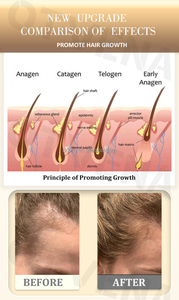 OTVENA Huile Capillaire Naturelle Anti-Chute Fortifiante et Lissante pour Cheveux Secs, Favorisant <span class=keywords><strong>la</strong></span> Croissance, Marque Privée, Vente en Gros - Product Image 4