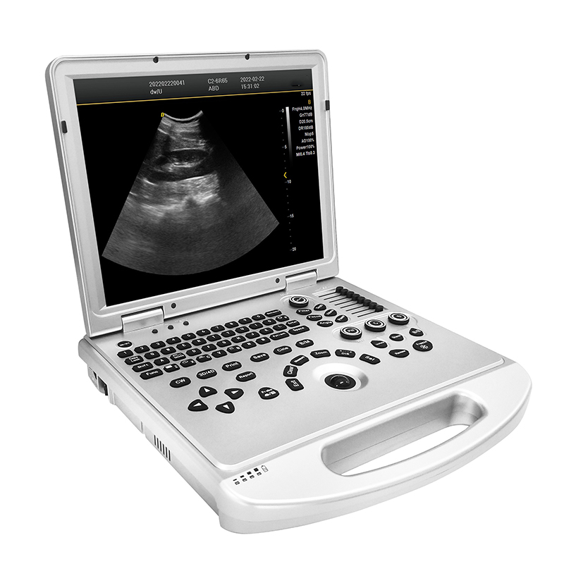 MN-UltraL3 3D probe Portable  Cardiac Obstetric Ultrasound color Doppler Ultrasound