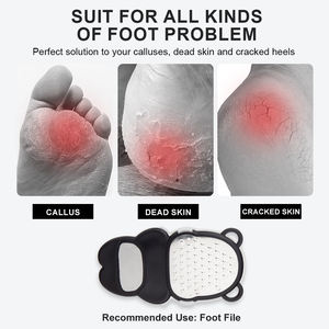 <span class=keywords><strong>Lime</strong></span> <span class=keywords><strong>à</strong></span> pied en acier inoxydable vente en gros exfoliant réparateur callosités élimination de la peau morte pédicure outil de soin pieds meulage grattoir - Product Image 2