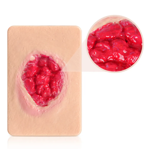 4 <strong>Types</strong> of Granulating Wound Cards for Medical Demonstration Skin Wound Simulation of <strong>Different</strong> <strong>Types</strong> Human Skin Trauma <strong>Models</strong> - Product Image 3