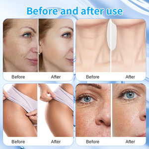 Appareil de lifting du visage et du corps à ultrasons haute fréquence anti-âge Hefu 2.0 de nouvelle génération, machine de suppression des rides SMAS - Product Image 5