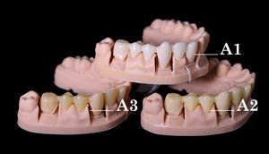 Impresora 3D Imprime Coronas Dentales Permanentes de Resina Sintética Polímero Marca <span class=keywords><strong>IFUN</strong></span> IF3180 Líquido de Alta Precisión Biocompatible 100% - Product Image 4