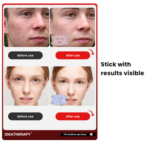 IDEATHERAPY masker silikon 510K, masker terapi lampu LED merah muda biru 3 warna disetujui - Product Image 4