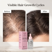 Sérum Capillaire Personnalisé à Base de Liposomes et Peptides pour Massage du Cuir Chevelu, Favorisant la Croissance des Cheveux, avec Redensyl, GHK-Cu, Biotine – Qualité Clinique GMPC, OEM, Marque Privée