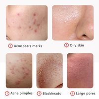 Sérum anti-âge et anti-acné, poudre de soin de la peau lyophilisée avec sérum de collagène hydrolysé, ingrédient de calendula pour le visage