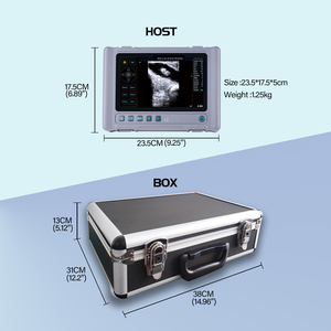 Giá tốt nhất xách tay cầm tay đầy đủ kỹ thuật số máy siêu âm hệ thống siêu âm HD hiển thị máy siêu âm y tế - Product Image 6
