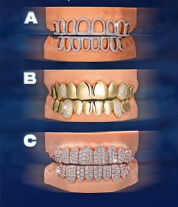 Grillz de Lujo de Plata de Ley 925 con Diamantes de Moissanita para Hombres y Mujeres, Joyería Única de Hip Hop con Dientes Personalizados Iced Out - Product Image 5