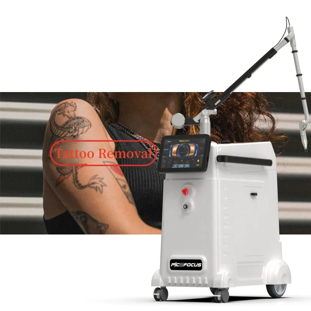 Nubway più nuovo design 1-10Hz picosecond regolabile q-switch nd yag laser tattoo removal equipment per clinica