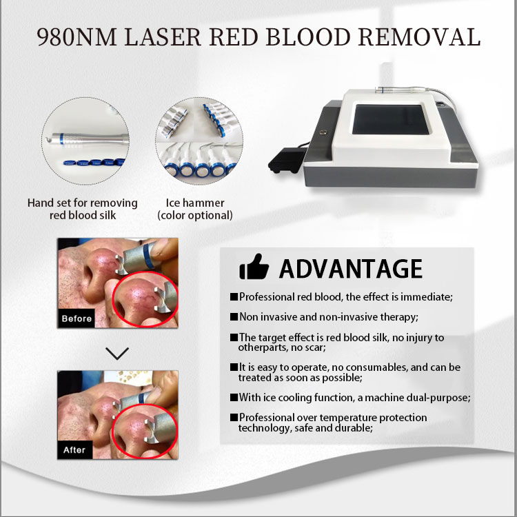 Máquina de remoção vascular do laser do diodo 980 nm, máquina da remoção do varizes do aranha do laser/980nm