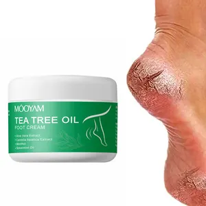 Meilleures ventes Crème à l'urée Soins des pieds Crème réparatrice des pieds pour peau rugueuse épaisse et sèche craquelée Callosités Crème pour les pieds à l'urée