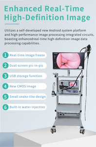 Endoscopio Medico Flessibile Videogastroscopio e Videocolonscopio per Uso Ospedaliero Adulto e Pediatrico - Product Image 3