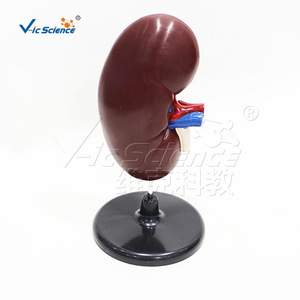 Modèle d'anatomie rénale, modèle de structure rénale humaine, aide pédagogique pour la démonstration en urologie - Product Image 4