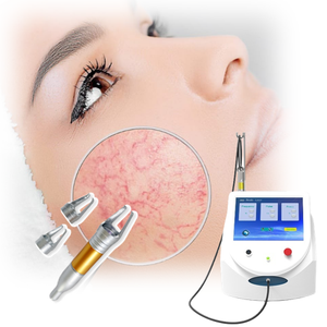 Máquina Portátil de <span class=keywords><strong>Tratamiento</strong></span> Láser 980nm para Eliminación de Várices, <span class=keywords><strong>Arañas</strong></span> <span class=keywords><strong>Vasculares</strong></span> y Capilares Sanguíneos - Product Image 6