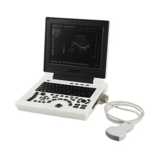 Mesin <span class=keywords><strong>Ultrasound</strong></span> hitam dan putih portabel dengan pencitraan resolusi tinggi dan baterai isi ulang - Product Image 1