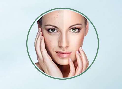 Кожа забеливая чистые 99% Snowwhite чистые выдержки завода 2