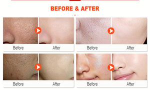 Etiqueta Privada coreana Nano hoja Facial blanqueadora <span class=keywords><strong>Aloe</strong></span> Vera Peel Off paquete Facial con su logotipo - Product Image 3