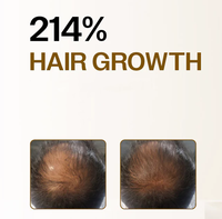 Serum Pertumbuhan Rambut Canggih Label Pribadi Roll-on Alami Mengurangi Kerontokan Rambut Merangsang Pertumbuhan Kembali Memperkuat Akar Serum Rambut Rosemary