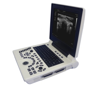 DMU03 Ecógrafo Médico Portátil de 12.1 Pulgadas, <span class=keywords><strong>Precio</strong></span> Económico, Imágenes Nítidas para Obstetricia y Ginecología - Product Image 3