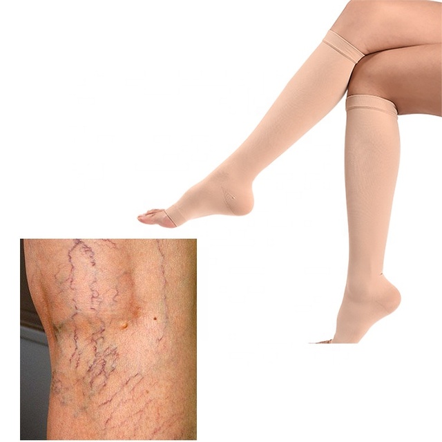 CE ISO Certified Unisex Compression Stockings for Varicose Veins Yiwu Rehabilitation Therapy Supplies Customizable OEM