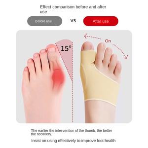 Séparateur d'<span class=keywords><strong>orthèse</strong></span> d'<span class=keywords><strong>orteil</strong></span> en gel <span class=keywords><strong>pour</strong></span> homme et femme <span class=keywords><strong>pour</strong></span> corriger l'os du <span class=keywords><strong>gros</strong></span> pied saillant le pouce Valgus Division artefact <span class=keywords><strong>pour</strong></span> <span class=keywords><strong>orteil</strong></span> - Product Image 3