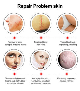 Máquina de Belleza Profesional de Radiofrecuencia con Tubo de CO2 para Rejuvenecimiento de la Piel, Reparación/Regeneración Vaginal y Eliminación de Arrugas - Product Image 2