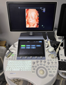 Fourniture et réparation de la machine à ultrasons VoLuson E8 - Product Image 3