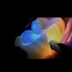 ไฟฉายอัจฉริยะ YY รุ่นส่งออก ไฟส่องฟัน แสงขาวเย็น 5500-7000K ใช้พลังงานไฟฟ้า ได้รับการรับรองมาตรฐาน CE - Product Image 2