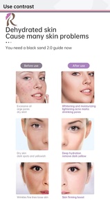 2025 mới nhất Electroporation máy mặt không cần thiết Mesotherapy súng ống các bộ phận ống tiêm mesotherapi bút với Nano đầu - Product Image 5