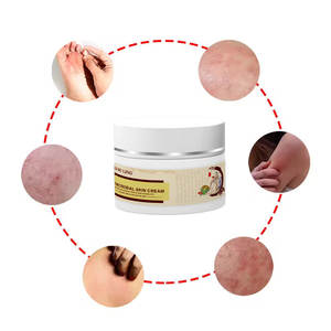 Krim kaya kelembaban Oem, dengan salep eksim Herbal tekstur kulit untuk menenangkan Itchiness dan meningkatkan - Product Image 6