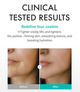 REJURAN Perfect V Tighter Dual Sheet Mask C PDRN Purecolla, mascarilla facial para levantar y reafirmar la línea de la mandíbula, antienvejecimiento, cuidado de la piel coreano, 4 unidades. - Product Image 3