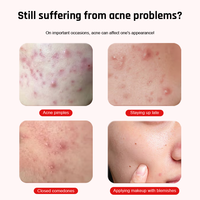 Meilleures ventes OEM Patchs anti-acné hypoallergéniques en forme d'étoile pour le visage, pour le traitement et l'absorption des boutons