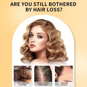 Minyak esensial minyak kulit kepala, minyak penguat rambut, biotimah infusi dan mendorong pertumbuhan rambut - Product Image 6