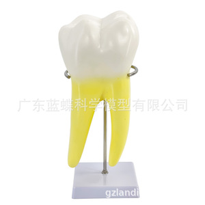Modèle anatomique de molaire humaine, grande dent pour l'enseignement en maternelle et la formation médicale, avec base et support. - Product Image 3