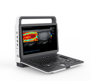 Ecógrafo Portátil de la Marca Zoncare M7, Proveedor Chino al por Mayor, Sistema de Ecografía Veterinaria Doppler a Color con Monitor LCD de 15.6 Pulgadas - Product Image 5